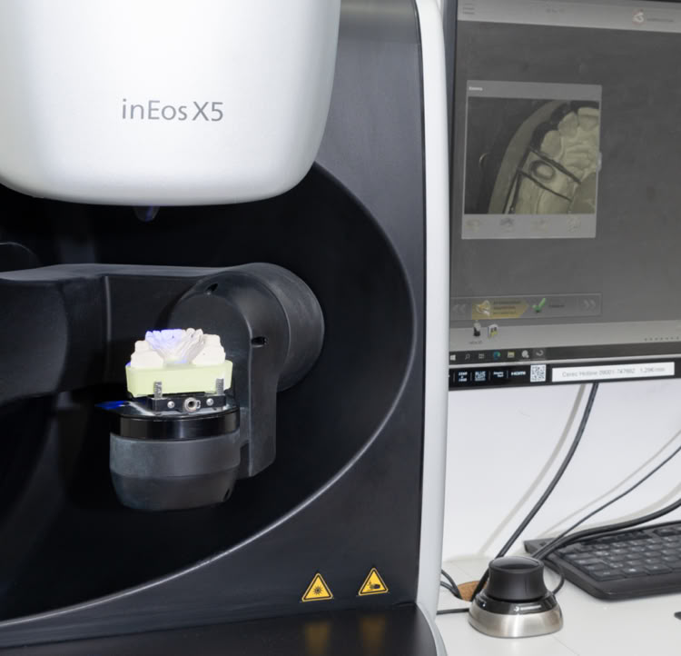 3D Scanner in Ratingen